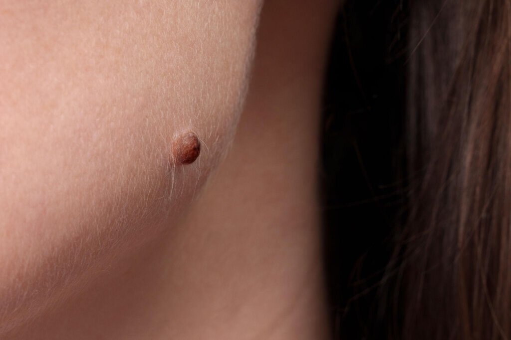頬のほくろが気になり指で触れている女性の横顔